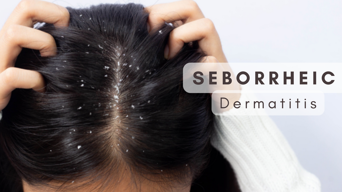 Taming Seborrheic Dermatitis: Hair Care Tips and Product Recommendations